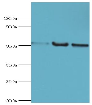 G3BP1 / G3BP Antibody - Western blot. All lanes: Carbonic anhydrase 1 antibody at 2 ug/ml. Lane 1: HepG2 whole cell lysate. Lane 2: 293T whole cell lysate. Lane 3: 293T whole cell lysate. Secondary antibody: Goat polyclonal to rabbit at 1:10000 dilution. Predicted band size: 52 kDa. Observed band size: 52 kDa.
