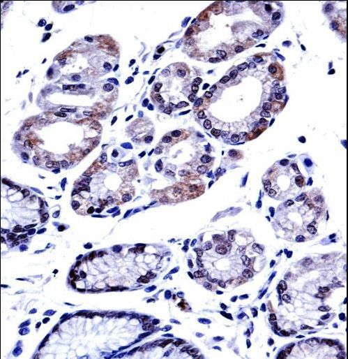 G3BP1 / G3BP Antibody - G3BP1 Antibody immunohistochemistry of formalin-fixed and paraffin-embedded human stomach tissue followed by peroxidase-conjugated secondary antibody and DAB staining.