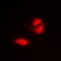 G3BP1 / G3BP Antibody - Immunofluorescent analysis of G3BP1 staining in A549 cells. Formalin-fixed cells were permeabilized with 0.1% Triton X-100 in TBS for 5-10 minutes and blocked with 3% BSA-PBS for 30 minutes at room temperature. Cells were probed with the primary antibody in 3% BSA-PBS and incubated overnight at 4 C in a humidified chamber. Cells were washed with PBST and incubated with a DyLight 594-conjugated secondary antibody (red) in PBS at room temperature in the dark. DAPI was used to stain the cell nuclei (blue).