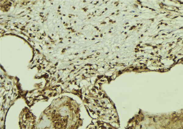 G3BP1 / G3BP Antibody - 1:100 staining mouse colon tissue by IHC-P. The sample was formaldehyde fixed and a heat mediated antigen retrieval step in citrate buffer was performed. The sample was then blocked and incubated with the antibody for 1.5 hours at 22°C. An HRP conjugated goat anti-rabbit antibody was used as the secondary.
