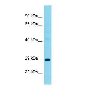 G3BP1 / G3BP Antibody - Western blot of Human Pancreas tumor. G3BP1 antibody dilution 1.0 ug/ml.  This image was taken for the unconjugated form of this product. Other forms have not been tested.