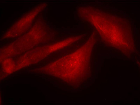 G3BP1 / G3BP Antibody - Immunofluorescence staining of methanol-fixed Hela cells.