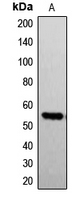G3BP1 / G3BP Antibody - Western blot analysis of G3BP1 (pS232) expression in A549 (A) whole cell lysates.