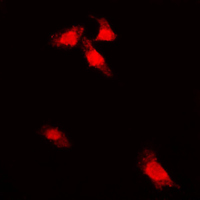 G3BP1 / G3BP Antibody - Immunofluorescent analysis of G3BP1 (pS232) staining in A549 cells. Formalin-fixed cells were permeabilized with 0.1% Triton X-100 in TBS for 5-10 minutes and blocked with 3% BSA-PBS for 30 minutes at room temperature. Cells were probed with the primary antibody in 3% BSA-PBS and incubated overnight at 4 C in a humidified chamber. Cells were washed with PBST and incubated with a DyLight 594-conjugated secondary antibody (red) in PBS at room temperature in the dark. DAPI was used to stain the cell nuclei (blue).