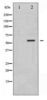 G3BP1 / G3BP Antibody - Western blot of G3BP-1 phosphorylation expression in 293 whole cell lysates,The lane on the left is treated with the antigen-specific peptide.