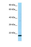 G5B / LY6G5B Antibody - LY6G5B antibody Western blot of Fetal Lung lysate. Antibody concentration 1 ug/ml.  This image was taken for the unconjugated form of this product. Other forms have not been tested.
