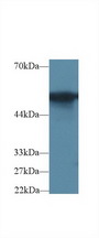 G6PD Antibody - Western Blot; Sample: Rat Colon lysate; Primary Ab: 2µg/ml Rabbit Anti-Rat G6PD Antibody Second Ab: 0.2µg/mL HRP-Linked Caprine Anti-Rabbit IgG Polyclonal Antibody