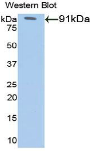 G6PD Antibody - Western blot of recombinant G6PD.  This image was taken for the unconjugated form of this product. Other forms have not been tested.