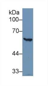 G6PD Antibody - Western Blot; Sample: Human Hela cell lysate; Primary Ab: 1µg/ml Rabbit Anti-Human G6PD Antibody Second Ab: 0.2µg/mL HRP-Linked Caprine Anti-Rabbit IgG Polyclonal Antibody