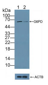 G6PD Antibody - Knockout Varification: Lane 1: Wild-type Hela cell lysate; Lane 2: G6PD knockout Hela cell lysate; Predicted MW: 62kd Observed MW: 60kd Primary Ab: 1µg/ml Rabbit Anti-Human G6PD Antibody Second Ab: 0.2µg/mL HRP-Linked Caprine Anti-Rabbit IgG Polyclonal Antibody