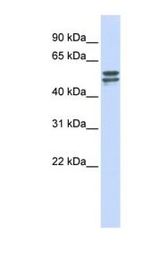 G6PD Antibody - G6PD antibody Western blot of MCF7 cell lysate. This image was taken for the unconjugated form of this product. Other forms have not been tested.