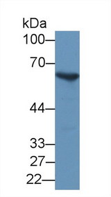 G6PD Antibody - Western Blot; Sample: Mouse Spleen lysate; Primary Ab: 1µg/ml Rabbit Anti-Mouse G6PD Antibody Second Ab: 0.2µg/mL HRP-Linked Caprine Anti-Rabbit IgG Polyclonal Antibody