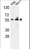 G6PD Antibody - Western blot of G6PD Antibody in K562,MCF-7 cell line lysates (35 ug/lane). G6PD (arrow) was detected using the purified antibody.