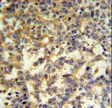 G6PD Antibody - G6PD Antibody IHC of formalin-fixed and paraffin-embedded testis followed by peroxidase-conjugated secondary antibody and DAB staining.