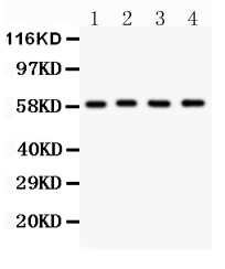 G6PD Antibody - G6PD antibody Western blot. All lanes: Anti G6PD at 0.5 ug/ml. Lane 1: HELA Whole Cell Lysate at 40 ug. Lane 2: MCF-7 Whole Cell Lysate at 40 ug. Lane 3: SKOV Whole Cell Lysate at 40 ug. Lane 4: HEPG2 Whole Cell Lysate at 40 ug. Predicted band size: 59 kD. Observed band size: 59 kD.