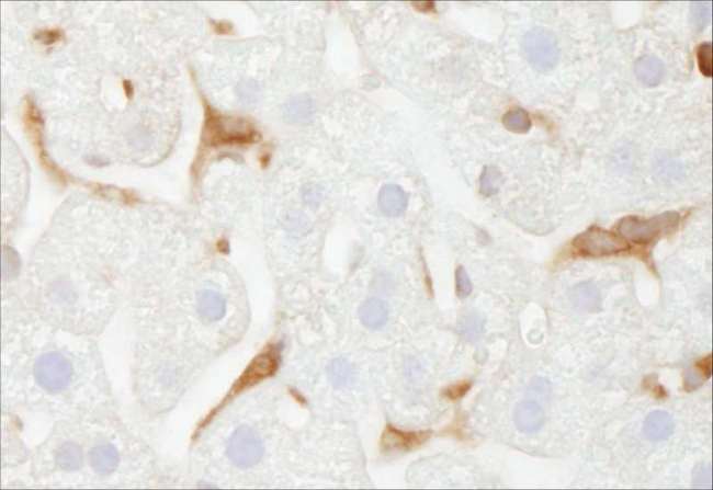 G6PD Antibody - Detection of Mouse G6PD by Immunohistochemistry. Samples: FFPE section of mouse liver. Antibody: Affinity purified rabbit anti-G6PD used at a dilution of 1:250. Detection: DAB.
