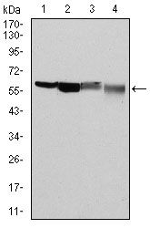 G6PD Antibody - G6PD Antibody in Western Blot (WB)