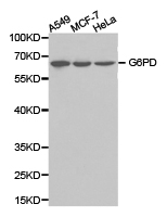 G6PD Antibody - Western blot of extracts of various cell lines, using G6PD antibody.