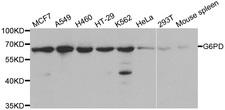 G6PD Antibody - Western blot analysis of extracts of various cell lines, using G6PD antibody at 1:1000 dilution. The secondary antibody used was an HRP Goat Anti-Rabbit IgG (H+L) at 1:10000 dilution. Lysates were loaded 25ug per lane and 3% nonfat dry milk in TBST was used for blocking.