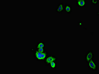 G6PD Antibody - Immunofluorescent analysis of HepG2 cells diluted at 1:100 and Alexa Fluor 488-congugated AffiniPure Goat Anti-Rabbit IgG(H+L)