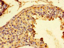 G6PD Antibody - Immunohistochemistry of paraffin-embedded human testis tissue at dilution of 1:100