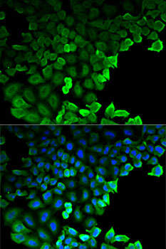 G6PD Antibody - Immunofluorescence analysis of HeLa cells using G6PD antibody. Blue: DAPI for nuclear staining.