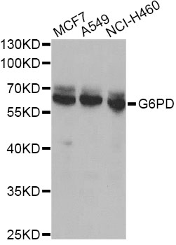G6PD Antibody - Western blot analysis of extracts of various cell lines, using G6PD antibody at 1:1000 dilution. The secondary antibody used was an HRP Goat Anti-Rabbit IgG (H+L) at 1:10000 dilution. Lysates were loaded 25ug per lane and 3% nonfat dry milk in TBST was used for blocking.