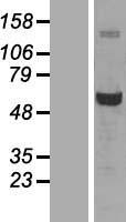 G6PD Protein - Western validation with an anti-DDK antibody * L: Control HEK293 lysate R: Over-expression lysate