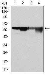 G6PDH Antibody - Western Blot: Glucose 6 Phosphate Dehydrogenase Antibody (2H7) - Western blot analysis using Glucose 6 Phosphate Dehydrogenase mouse mAb against HeLa (1), MCF-7 (2), Jurkat (3) and K562 (4) cell lysate.