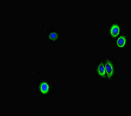 GAA / Alpha-Glucosidase, Acid Antibody - Immunofluorescent analysis of HepG2 cells diluted at 1:100 and Alexa Fluor 488-congugated AffiniPure Goat Anti-Rabbit IgG(H+L)