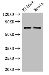 GAA / Alpha-Glucosidase, Acid Antibody - Western Blot Positive WB detected in:mouse kidney tissue,mouse brain tissue All Lanes: GAA Antibody at 3ug/ml Secondary Goat polyclonal to rabbit IgG at 1/50000 dilution Predicted band size: 70,76, 106 kDa Observed band size: 70 kDa
