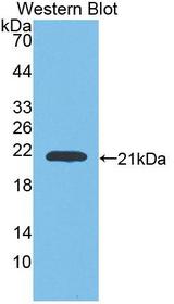 GAA / Alpha-Glucosidase, Acid Antibody - Western blot of GAA / Alpha-Glucosidase, Acid antibody.