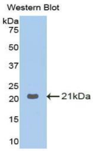 GAA / Alpha-Glucosidase, Acid Antibody - Western blot of recombinant GAA.  This image was taken for the unconjugated form of this product. Other forms have not been tested.