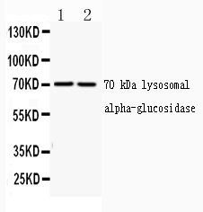GAA / Alpha-Glucosidase, Acid Antibody - Western blot analysis of GAA expression in rat liver extract (lane 1) and A549 whole cell lysates (lane 2). GAA at 70KD was detected using rabbit anti-GAA Antigen Affinity purified polyclonal antibody at 0.5 µg/mL. The blot was developed using chemiluminescence (ECL) method.