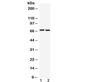 GAA / Alpha-Glucosidase, Acid Antibody - Western blot testing of 1) rat liver and 2) human A549 cell lysate with GAA antibody at 0.5ug/ml. Epected molecular weight ~110 kDa (precursor), 76 and 70 kDa (lysosomal forms).