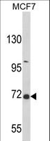 GAB2 Antibody - Western blot of GAB2 Antibody in MCF7 cell line lysates (35 ug/lane). GAB2 (arrow) was detected using the purified antibody.