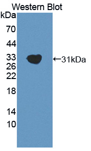 GAB2 Antibody - Western blot of GAB2 antibody.