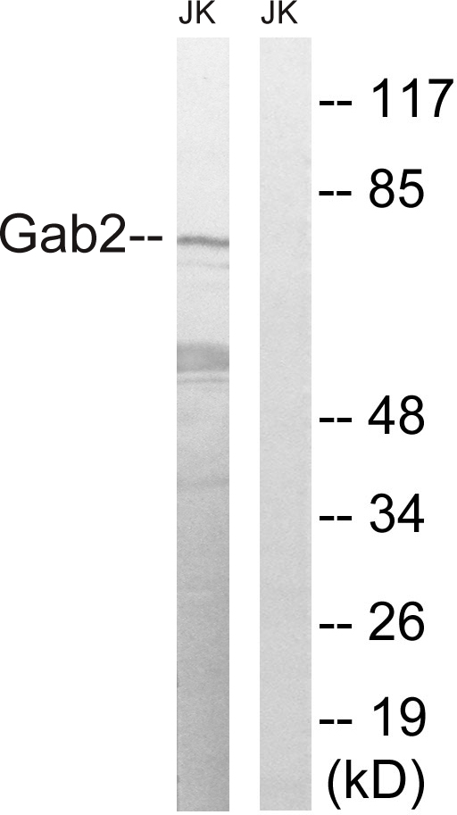 GAB2 Antibody - Western blot analysis of lysates from Jurkat cells, treated with TNF 2500U/ml 30', using Gab2 Antibody. The lane on the right is blocked with the synthesized peptide.