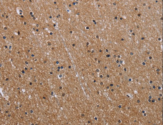 GAB2 Antibody - Immunohistochemistry of paraffin-embedded Human brain using GAB2 Polyclonal Antibody at dilution of 1:40.