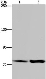 GAB2 Antibody - Western blot analysis of HeLa and K562 cell, using GAB2 Polyclonal Antibody at dilution of 1:300.