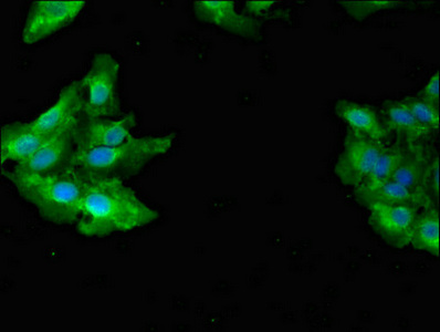 GAB2 Antibody - Immunofluorescent analysis of Hela cells diluted at 1:100 and Alexa Fluor 488-congugated AffiniPure Goat Anti-Rabbit IgG(H+L)