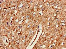 GAB2 Antibody - Immunohistochemistry of paraffin-embedded human brain tissue at dilution of 1:100