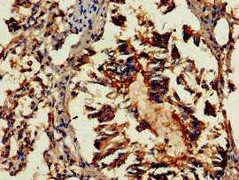 GAB2 Antibody - Immunohistochemistry of paraffin-embedded human lung tissue at dilution of 1:100