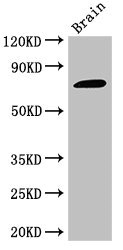 GAB2 Antibody - Western Blot Positive WB detected in:Mouse brain tissue All Lanes:GAB2 antibody at 2.5µg/ml Secondary Goat polyclonal to rabbit IgG at 1/50000 dilution Predicted band size: 75,70 KDa Observed band size: 75 KDa