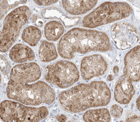 GAB2 Antibody - 1:100 staining human kidney tissue by IHC-P. The tissue was formaldehyde fixed and a heat mediated antigen retrieval step in citrate buffer was performed. The tissue was then blocked and incubated with the antibody for 1.5 hours at 22°C. An HRP conjugated goat anti-rabbit antibody was used as the secondary.