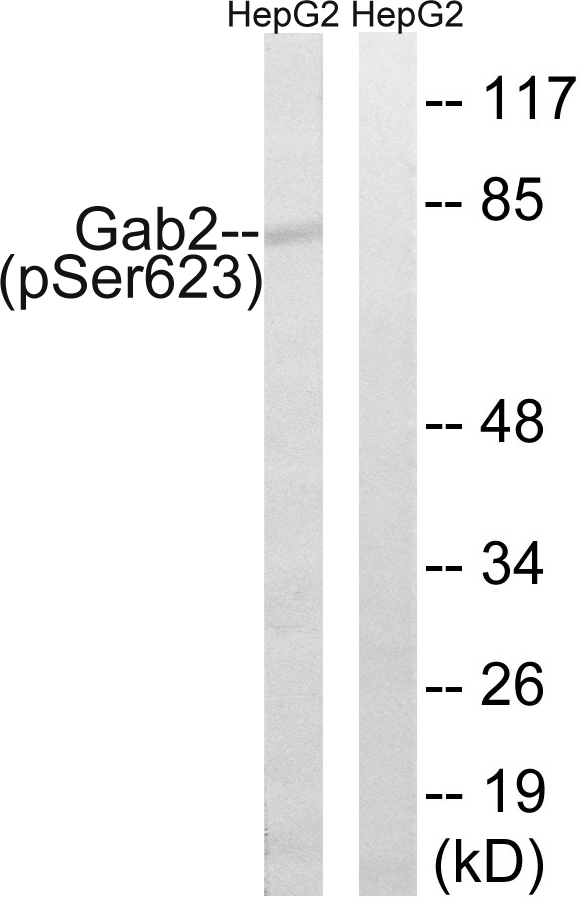 GAB2 Antibody - Western blot analysis of lysates from HepG2 cells treated with PMA 125ng/ml 30', using Gab2 (Phospho-Ser623) Antibody. The lane on the right is blocked with the phospho peptide.