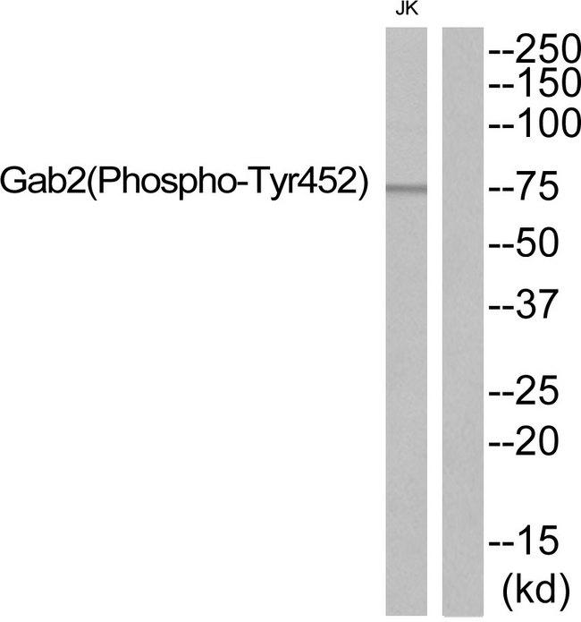 GAB2 Antibody - Western blot analysis of extracts from JK, using Gab2 (Phospho-Tyr452) Antibody.