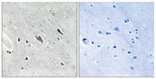 GAB2 Antibody - Immunohistochemistry analysis of paraffin-embedded human brain, using Gab2 (Phospho-Tyr643) Antibody. The picture on the right is blocked with the phospho peptide.