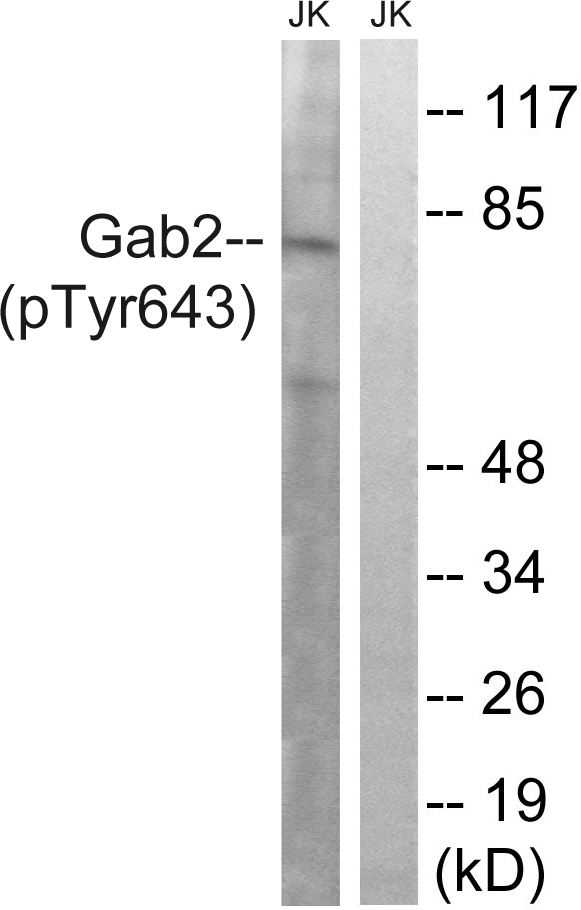 GAB2 Antibody - Western blot analysis of lysates from Jurkat cells treated with IFN 2500U/ML 30', using Gab2 (Phospho-Tyr643) Antibody. The lane on the right is blocked with the phospho peptide.