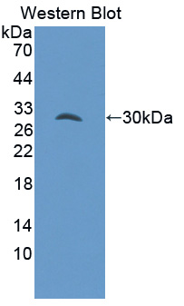 GAB3 Antibody - Western blot of GAB3 antibody.